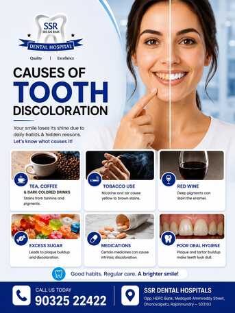 Kurnool, Dental, Causes Of Tooth Discoloration &ndash; Expert Dental Care By SSR Dental Hospital