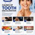 Causes Of Tooth Discoloration &ndash; Expert Dental Care By SSR Dental Hospital