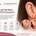 Is Ear Hole Repair Permanent? What Patients Should Know