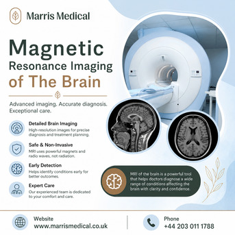 London, Health, Where Can You Book A Private Magnetic Resonance Imaging Of The Brain In London?