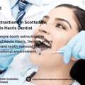 Simple Tooth Extractions | Kevin Harris Dentist Scottsdale