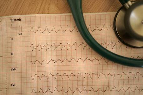 Mumbai, Health, Expert SVT Tachycardia ECG Care At The Heart.ae