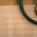 Expert SVT Tachycardia ECG Care At The Heart.ae