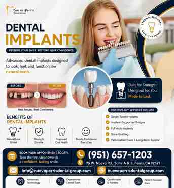 New York, Dental, Dental Implants In Nuevo, California | Dr. Tejas Modi