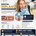 Dental Implants In Nuevo, California | Dr. Tejas Modi