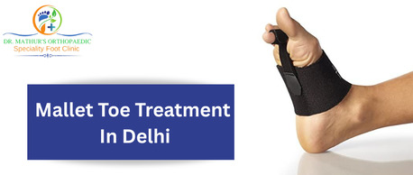 New Delhi, Health, Mallet Toe Treatment In Delhi At Dr. Mathur Orthopaedic