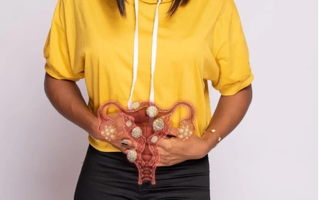 New York, Health, UFE Fibroid Treatment Near Me | Expert Non-Surgical Fibroid Care