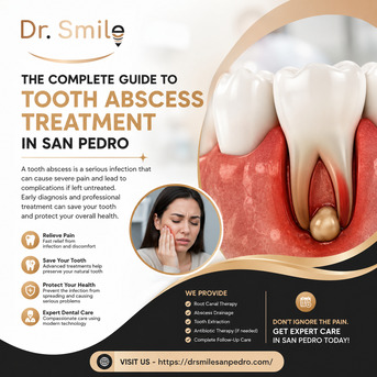 New York, Business, Tooth Abscess Treatment In San Pedro | Dr. Smile San Pedro
