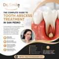 Tooth Abscess Treatment In San Pedro | Dr. Smile San Pedro
