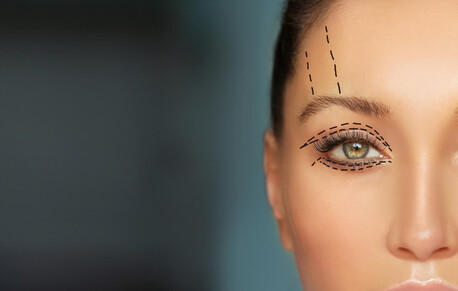 Mumbai, Health, Eyelid Surgery In Mumbai &ndash; Expert Blepharoplasty Solutions