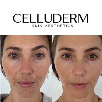 Sydney, Business, Laser Clinic Richmond: Personalised Laser Skin Treatments At CelluDerm