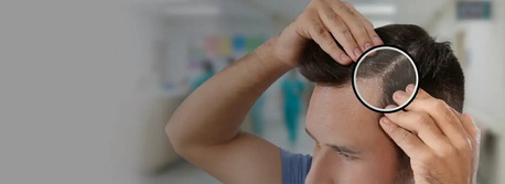 New Delhi, Health & Beauty Items, INR 500000,  Breathe New Life Into Your Scalp!