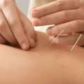 Pain Management Acupuncture In NYC | Back, Neck & Sciatica Relief