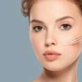 Anti-Aging Botox Treatment In South Delhi