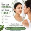 Trusted Dermatologist In Kompally For Advanced Skin Care