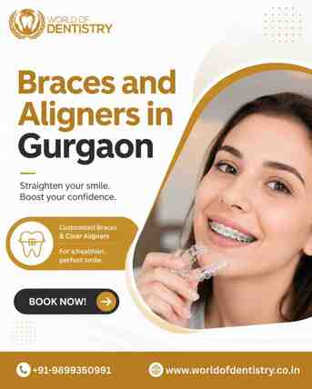 Gurgaon, Dental, Looking For The Best Braces And Aligners In  Gurgaon