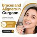 Looking For The Best Braces And Aligners In  Gurgaon