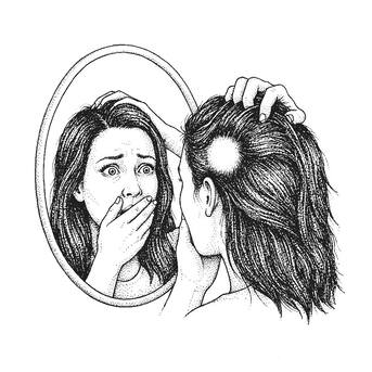 Pune, Guest Posting, Alopecia Symptoms Getting Worse? Don