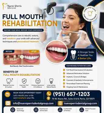 New York, Dental, Full Mouth Rehabilitation In Perris | Dr. Tejas Modi