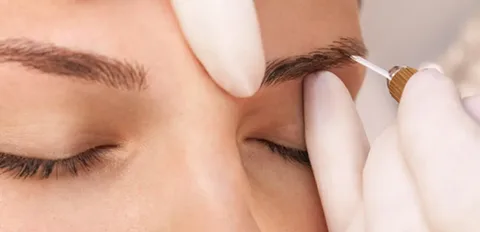 New Delhi, Health, Get Natural-Looking Hair And Eyebrow Transplants In Delhi
