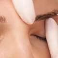 Get Natural-Looking Hair And Eyebrow Transplants In Delhi