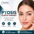 Restore Your Confidence With Ptosis Plastic Surgery