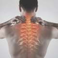 Scoliosis Treatment In Abu Dhabi | Bone Care One Day Surgery Center