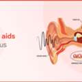 INR 30,  Hearing Aid For Tinnitus - Zenaud