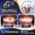 Restore Your Smile Permanently: Dental Implants In AS Rao Nagar