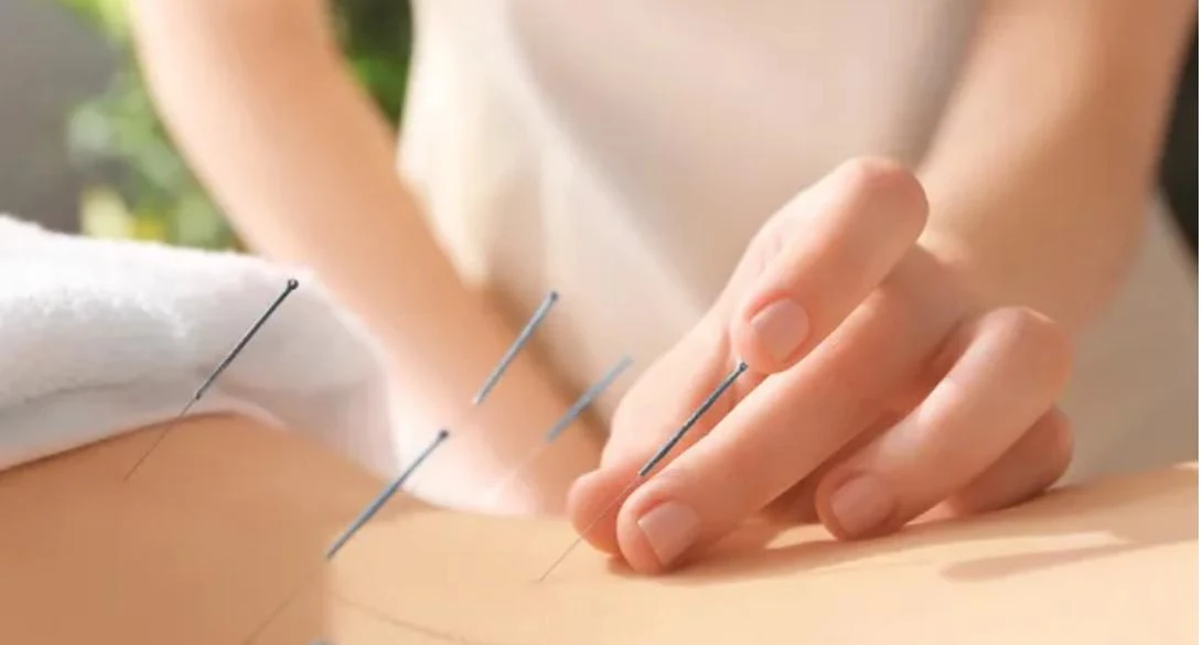 New York, Health, Need A Doctor Of Acupuncture? | OM Bright Wellness USA