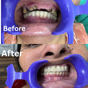 Jaipur, Health, Arihant Dental Clinic