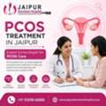 PCOS Treatment In Jaipur | Expert Gynecologist For PCOS Care