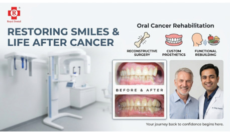 Jaipur, Local News, Life After Recovery: The Crucial Role Of Oral Cancer Rehabilitation In Jaipur