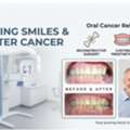 Life After Recovery: The Crucial Role Of Oral Cancer Rehabilitation In Jaipur