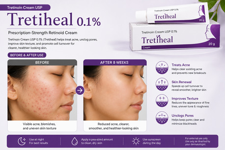 Dubai, Items Wanted, Cream Tretin 0.05 &ndash; Dermatologist- Recommended Retinoid For Acne & Skin Renewal