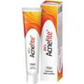Acne Fite| JRK's Acne Fite