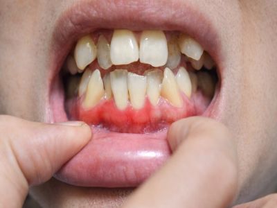 Kolkata, General, Quality Dental Care At AB Dentologic &ndash; Dental Clinic Newtown