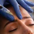 Refine Your Facial Features With Alarplasty Treatment In Delhi