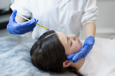 London, Health, Trusted Clinic For The Best PRP Hair Restoration
