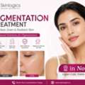 Laser Pigmentation Treatment In Noida &ndash; Safe & Effective