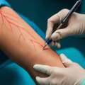 Vascular Surgery In Madurai