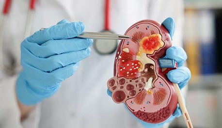 Madurai, Health, Nephrology Hospital In Madurai