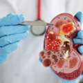 Nephrology Hospital In Madurai
