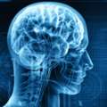 Best Neurology Hospital In Madurai