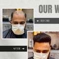 INR 8000,  Best Hair Patch Center Kolkata | Indian Hair World