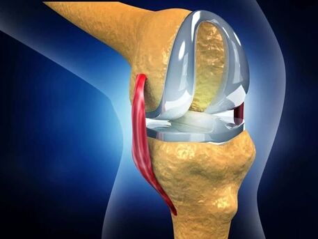 New Delhi, Health, Joint Replacement Surgery East Delhi