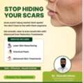 Restore Your Skin Confidence With Expert Dermatologist In Kompally