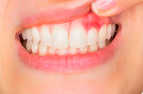 London, Health, Healthy Gums Support Better Oral Health Every Day