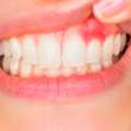 Healthy Gums Support Better Oral Health Every Day