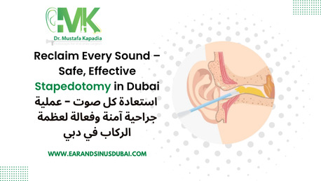 Dubai, Health, Stapedotomy Surgery In Dubai